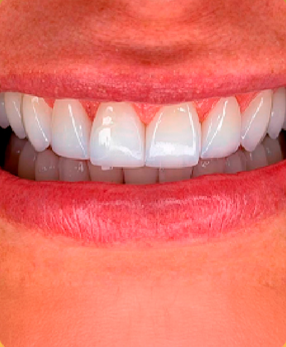 dente1.jpg