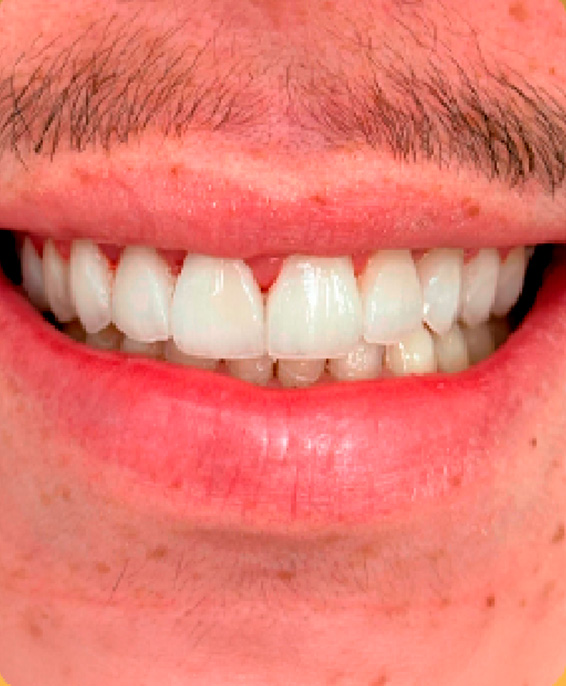 dente2.jpg