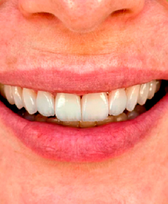 dente3.jpg