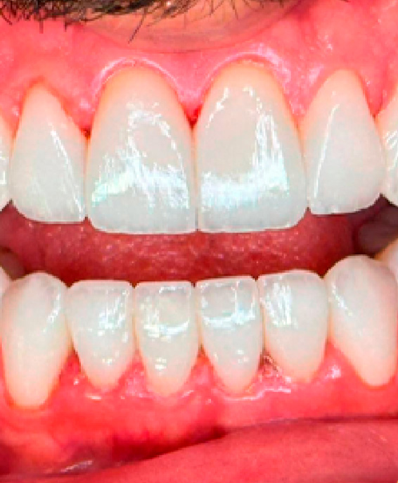 dente4.jpg